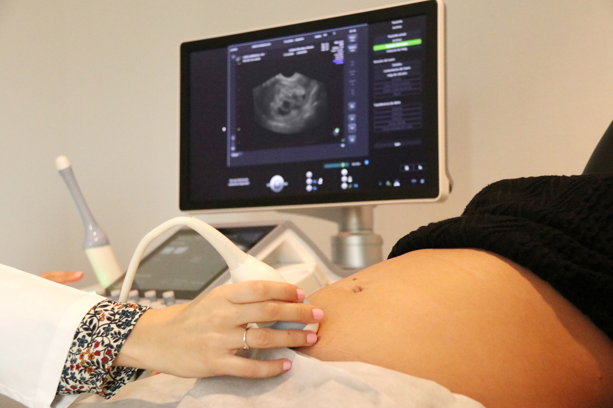 Molar Pregnancy Ultrasound: A Complete Guide for Parents